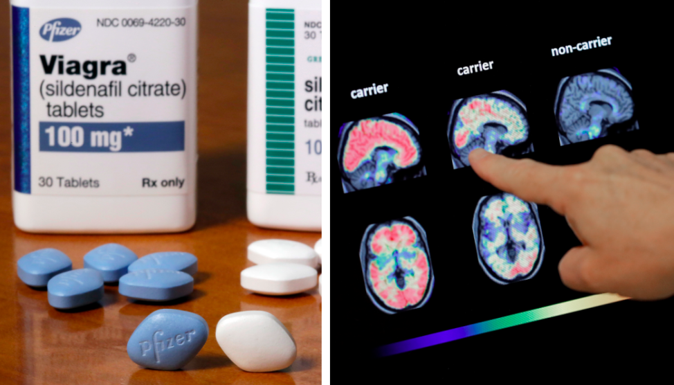 En ny studie visar att Viagra kan minska risken för Alzheimers. 